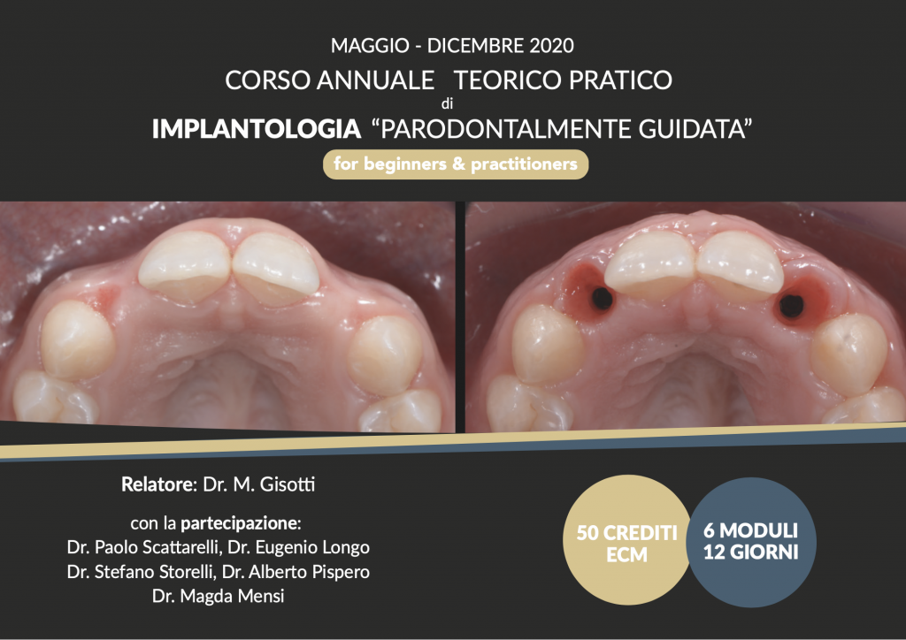 Corso di Implantologia “Parodontalmente Guidata” 2020