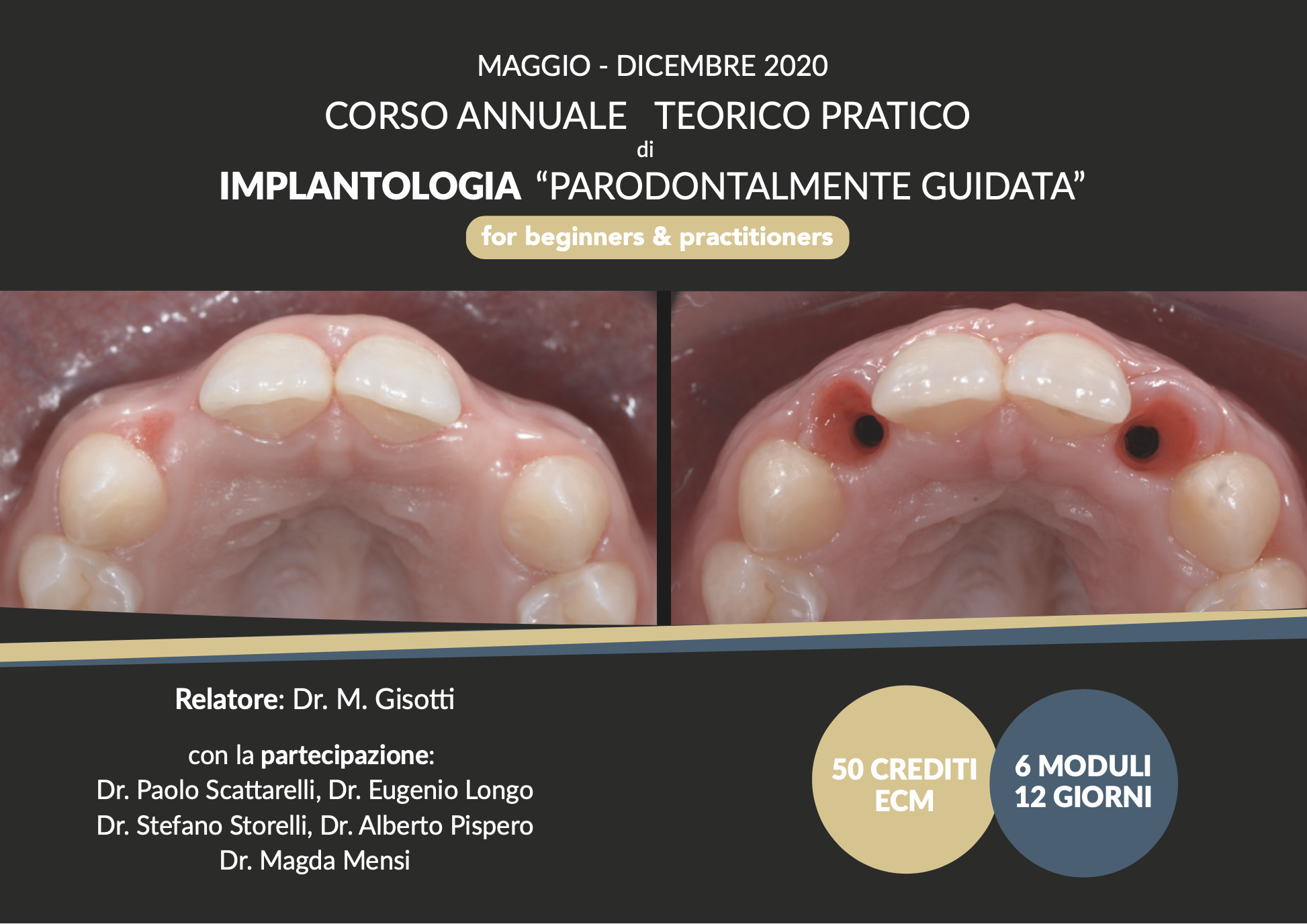Corso di Implantologia “Parodontalmente Guidata” 2020