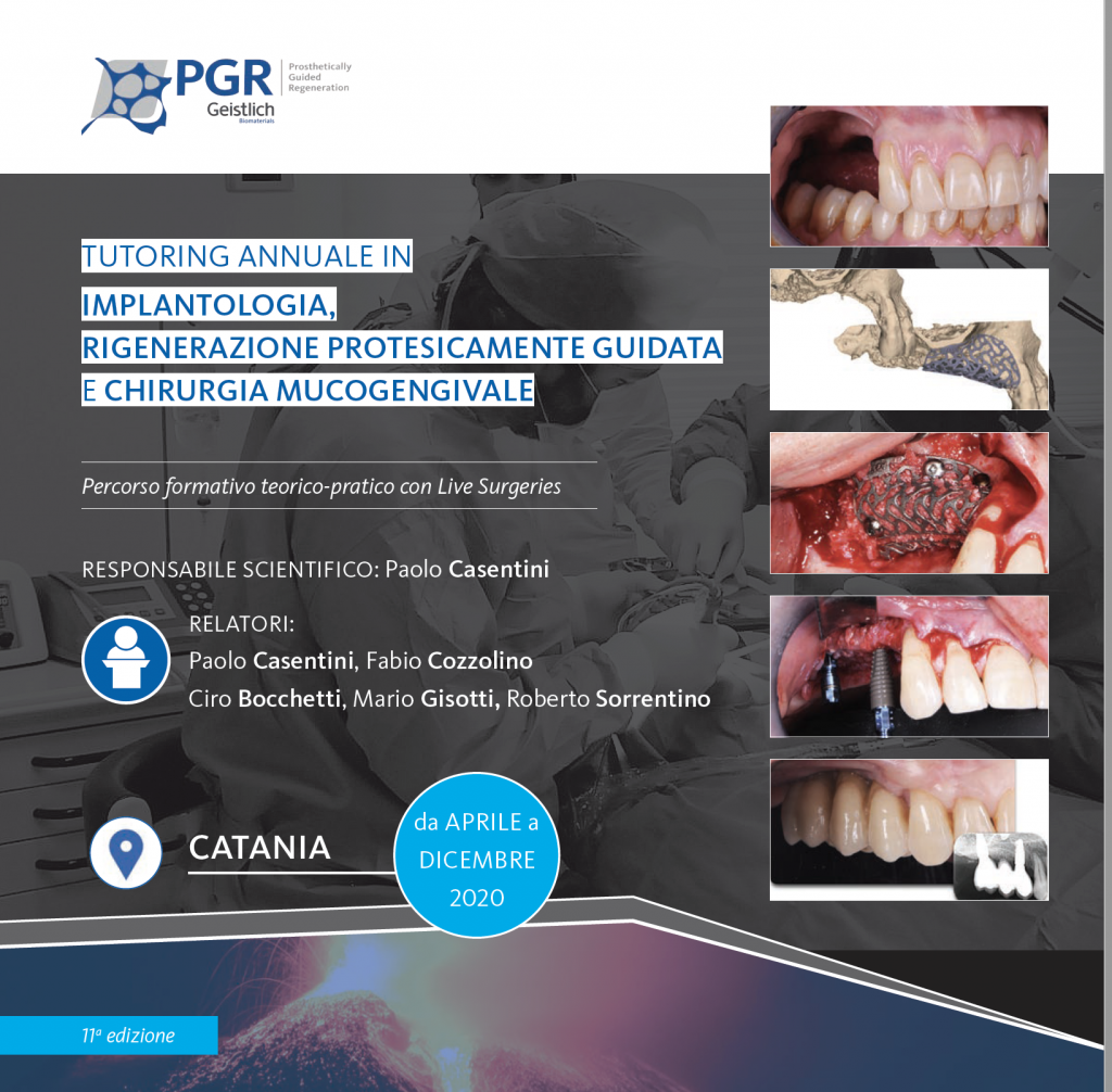 Tutoring annuale in implantologia, Rigenerazione Protesicamente Guidata e Chirurgia Mucogengivale: Percorso formativo con Live Surgery
