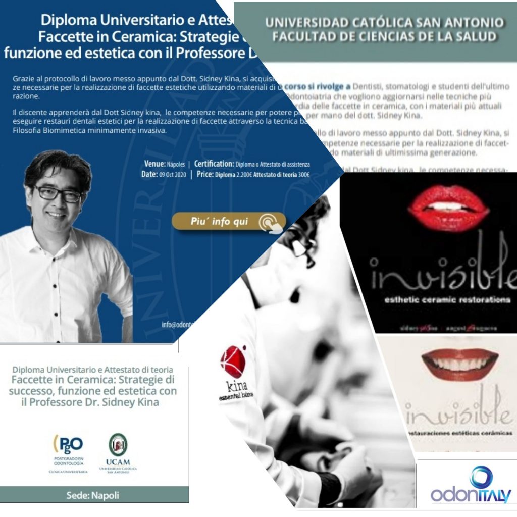 Faccette in ceramica:strategie di successo, funzione ed estetica