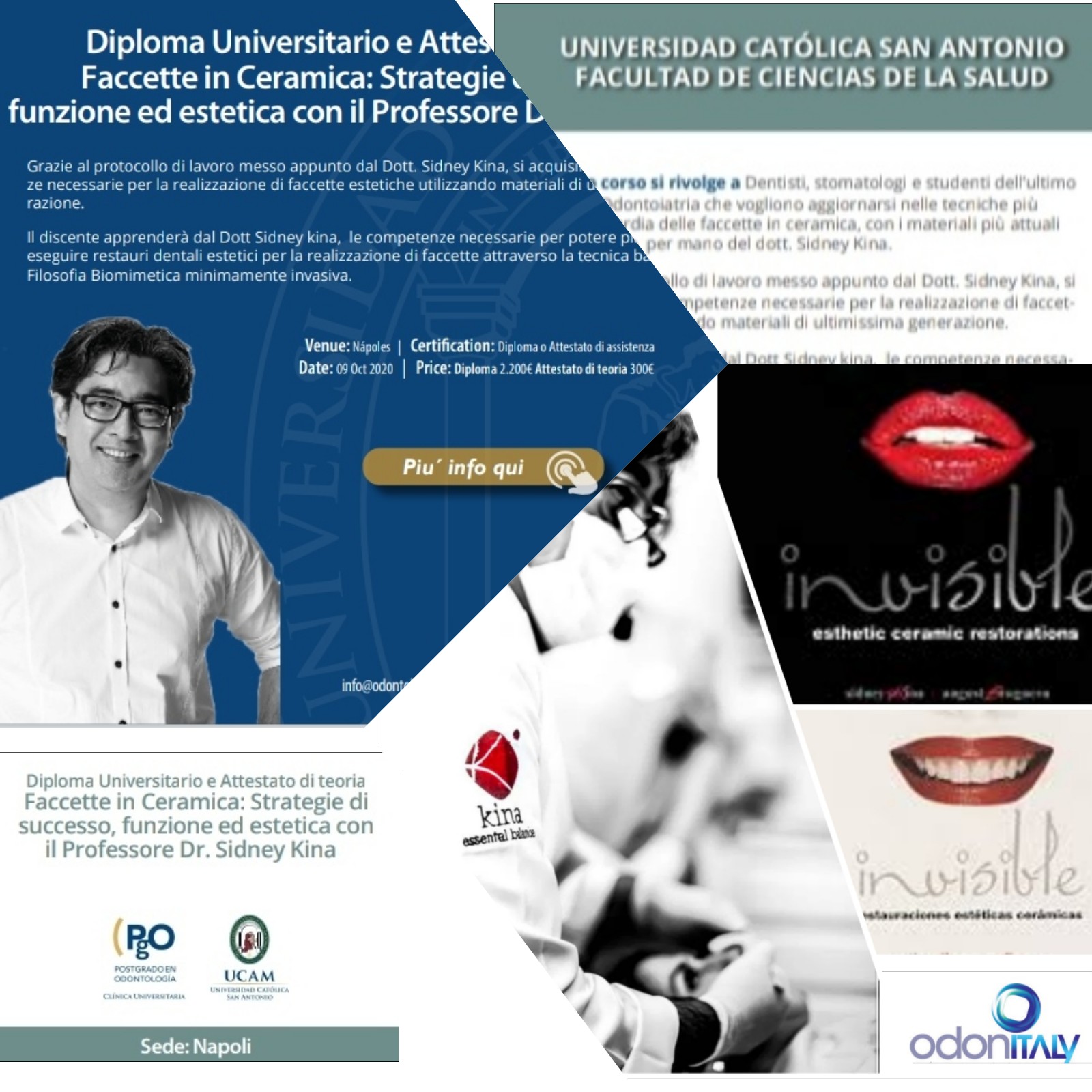 Faccette in ceramica:strategie di successo, funzione ed estetica