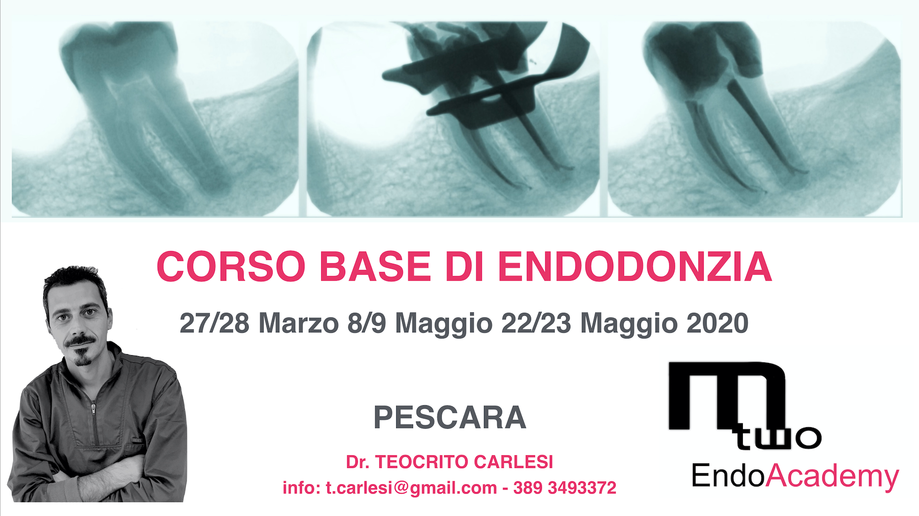 Corso base di Endodonzia