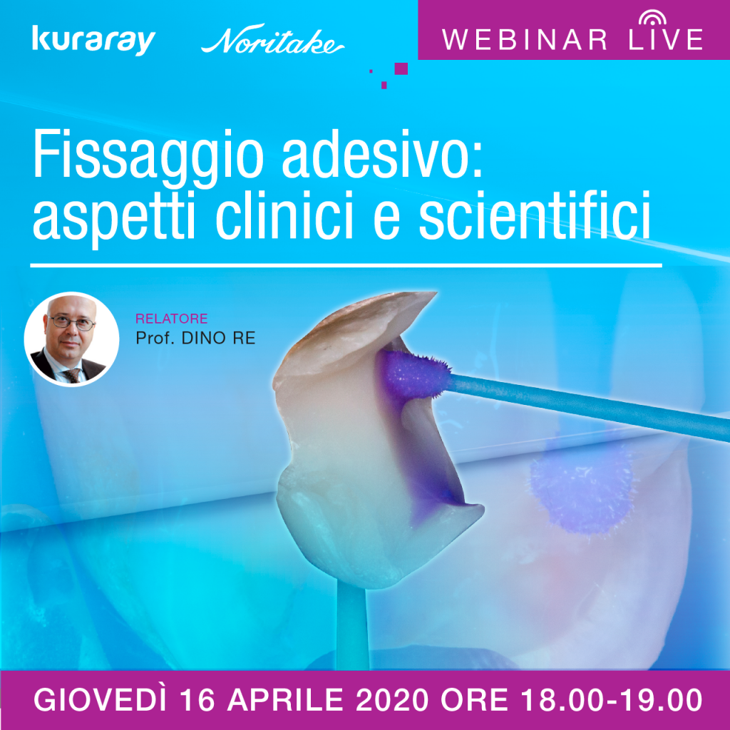 Fissaggio adesivo: aspetti clinici e scientifici