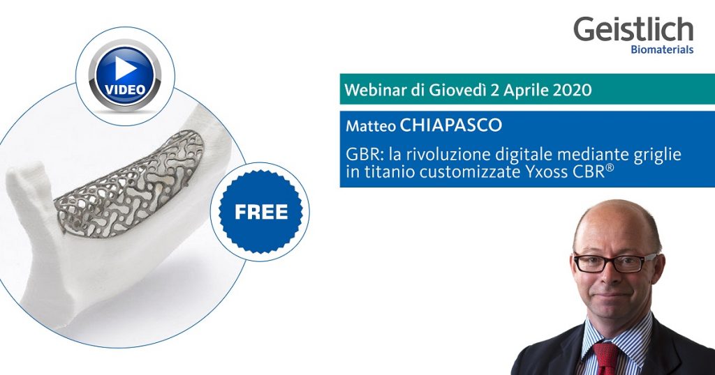 GBR: LA RIVOLUZIONE DIGITALE MEDIANTE GRIGLIE IN TITANIO CUSTOMIZZATE YXOSS CBR®