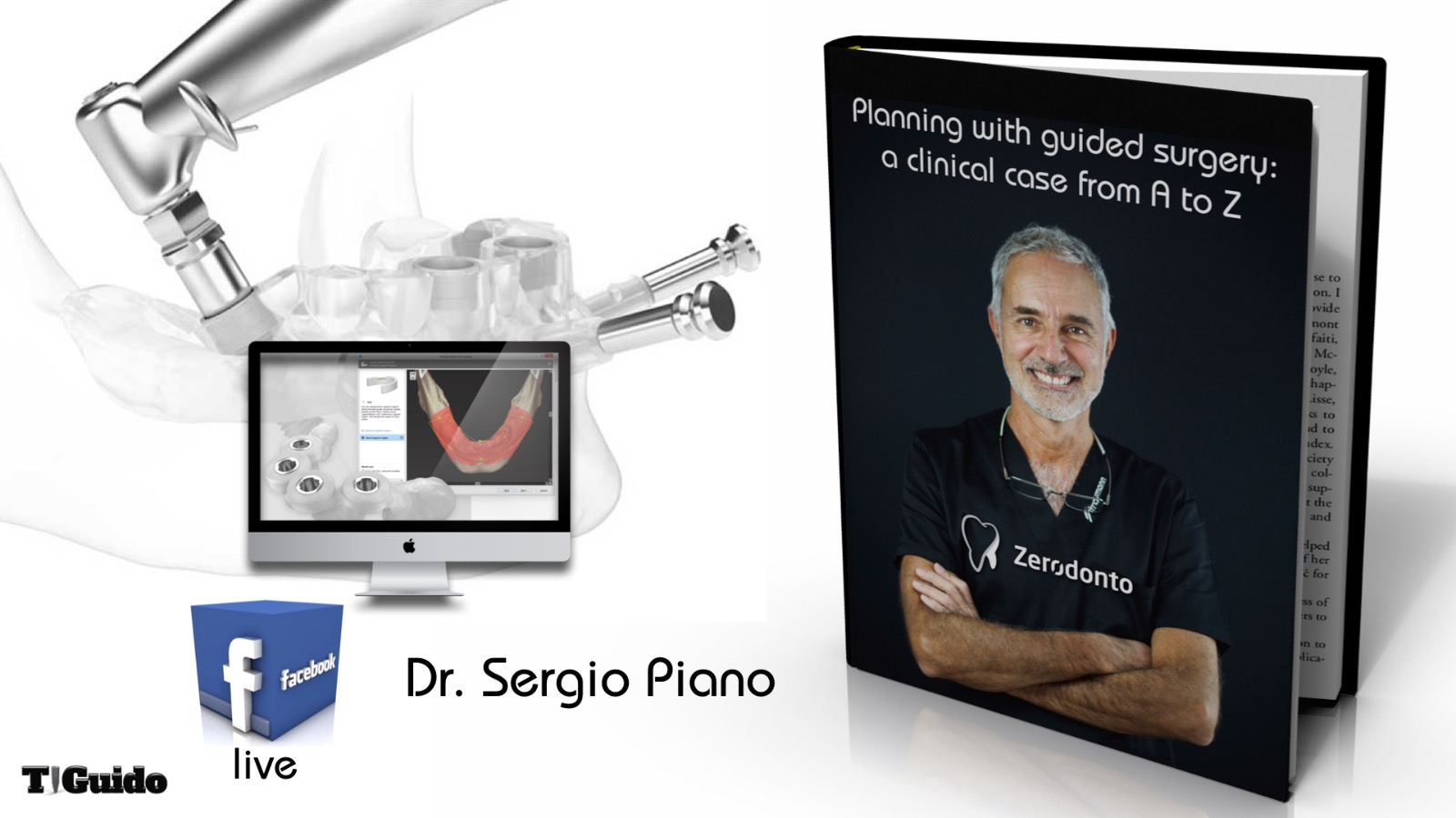 Planning with guided surgery: a clinical case from A to Z