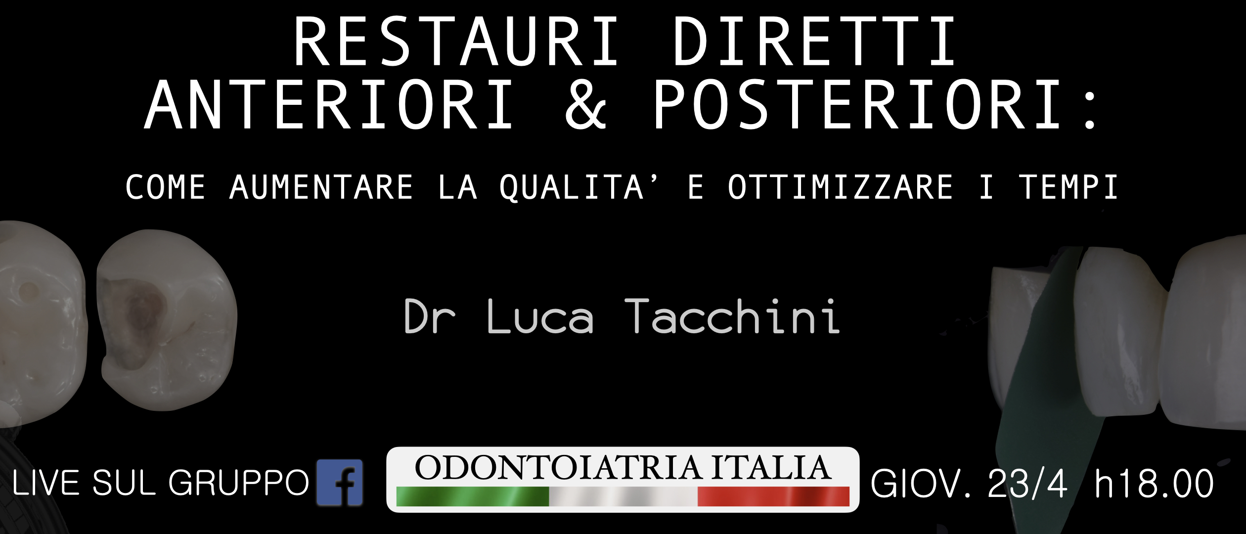 RESTAURI DIRETTI ANTERIORI E POSTERIORI: COME AUMENTARE LA QUALITA’ E OTTIMIZZARE I TEMPI – DR Luca Tacchini