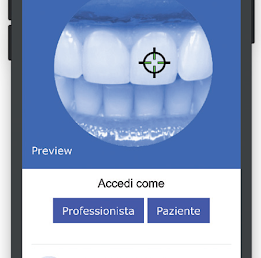 INTACT TOOTH per lo screening in remoto dello salute dello smalto del tuo paziente