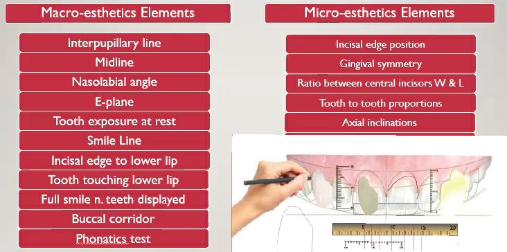 Smile Design : High performance planning