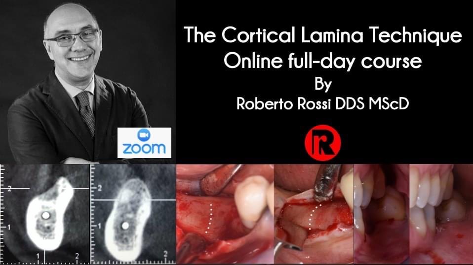 The Cortical Lamina Technique