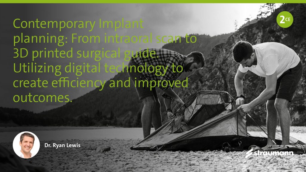 Contemporary Implant planning: From intraoral scan to 3D printed surgical guide.