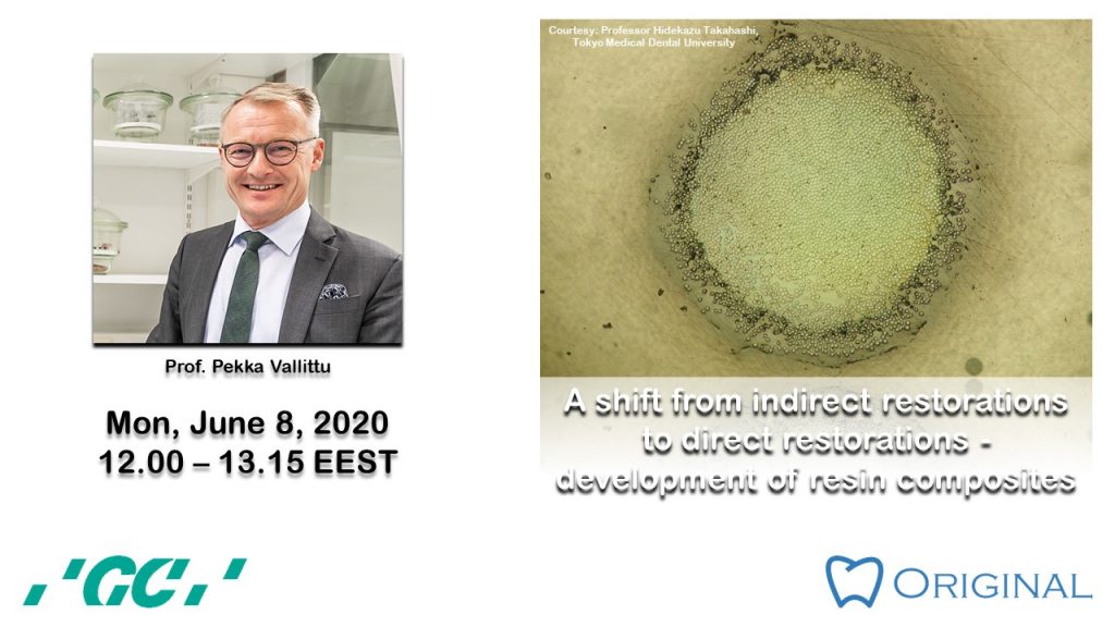 A shift from indirect restorations to direct restorations – development of resin composites