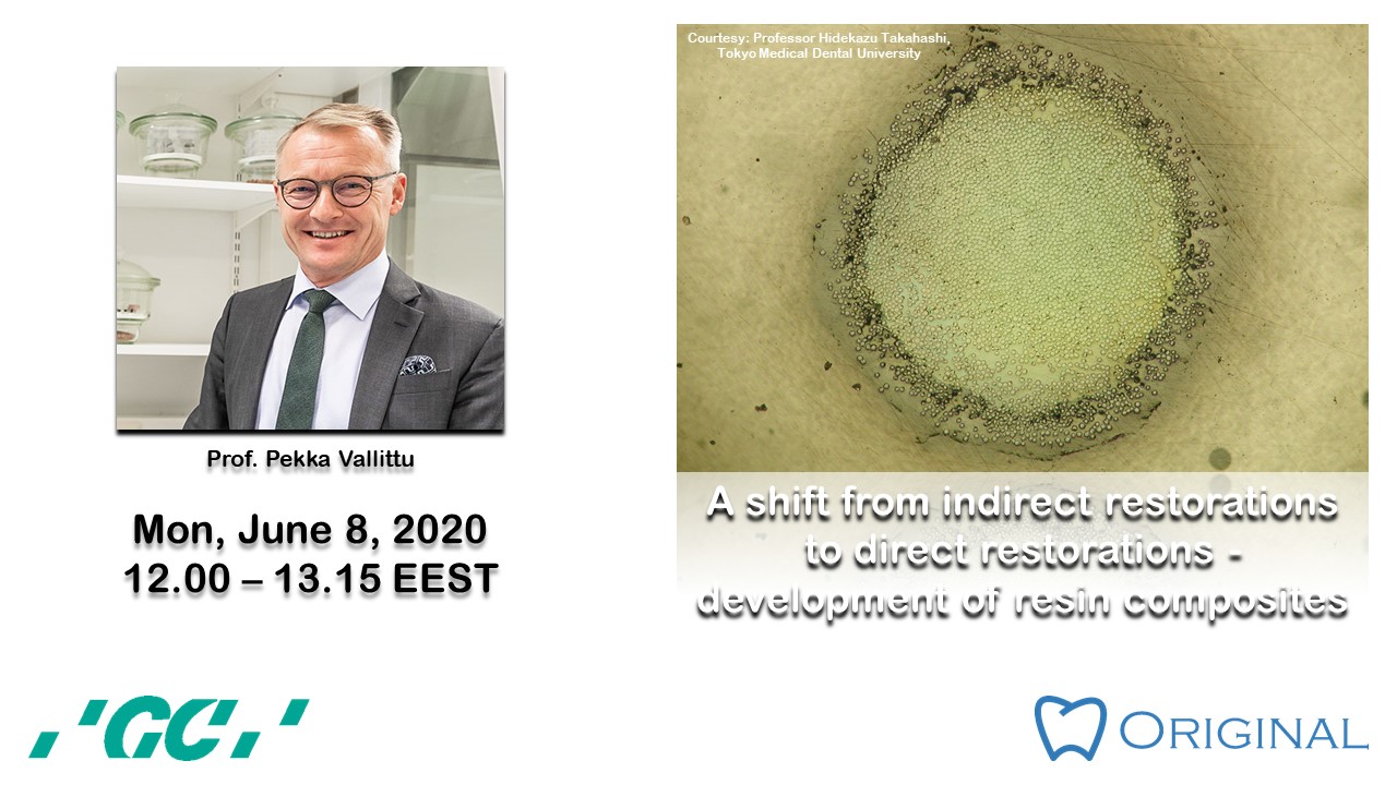 A shift from indirect restorations to direct restorations – development of resin composites