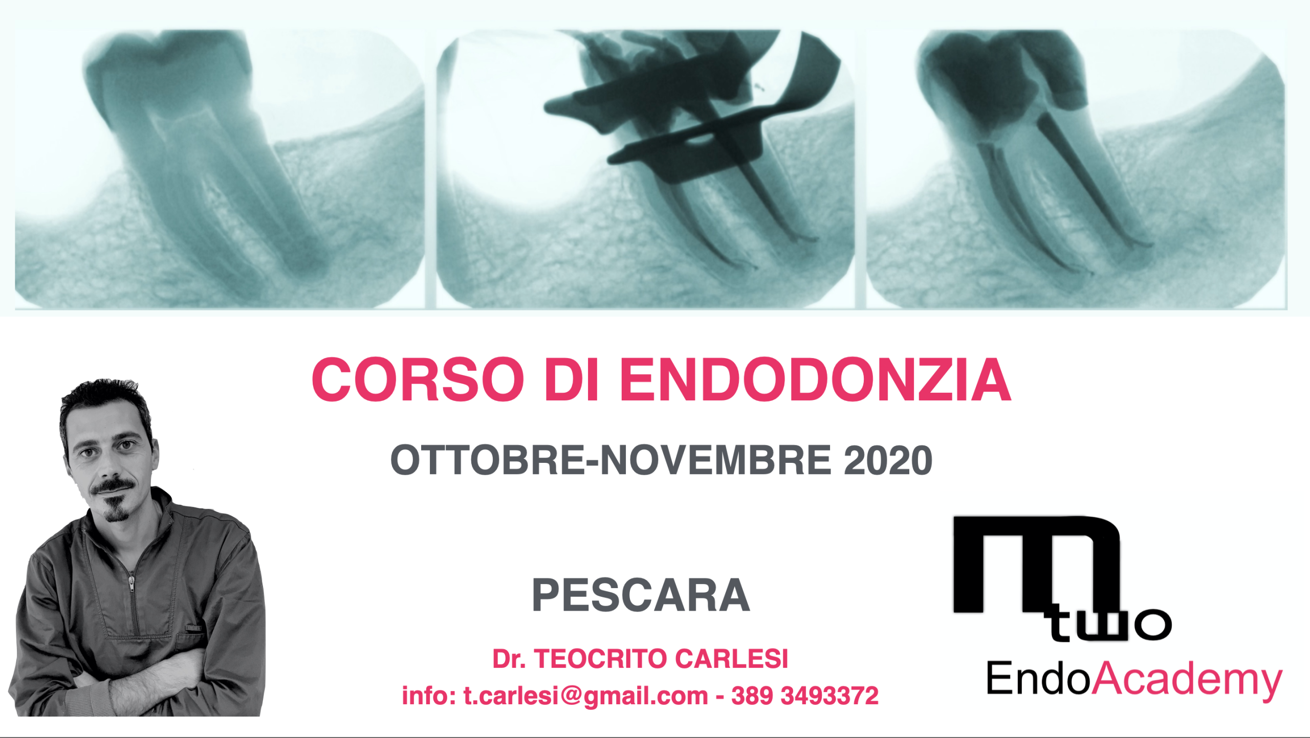 Corso Endodonzia Dott. Carlesi Teocrito- Pescara