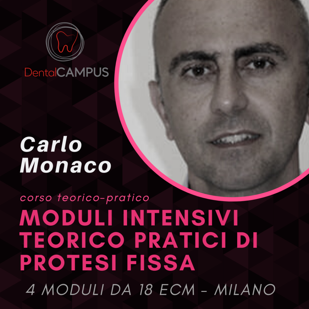 CORSO MODULARE INTENSIVO DI PROTESI FISSA: DALLA PROTESI ADESIVA ALLA PROTESI TRADIZIONALE e IMPLANTARE – Carlo Monaco