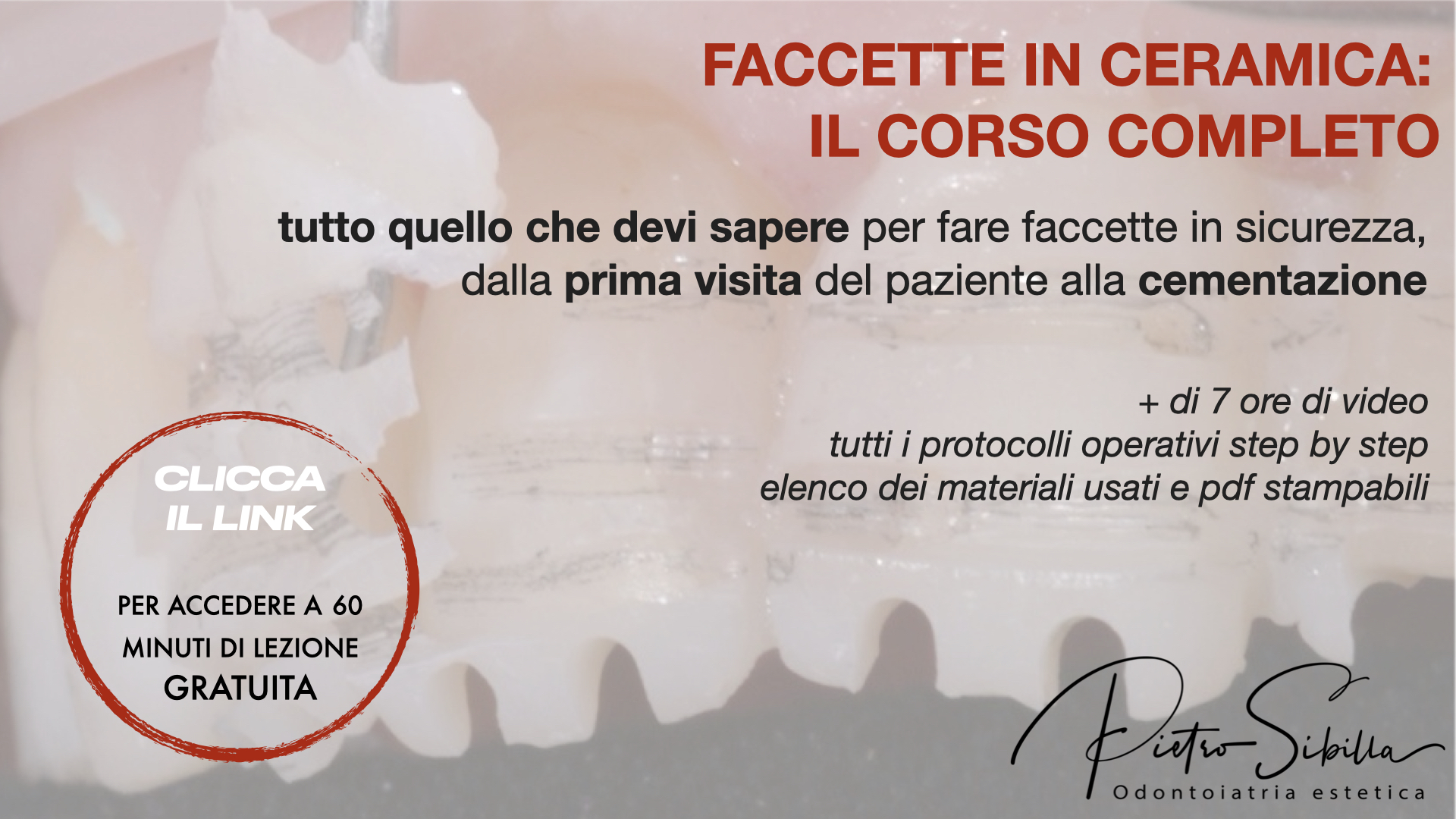 Faccette in Ceramica – Il Corso Completo (tutto quello che devi sapere, step by step)