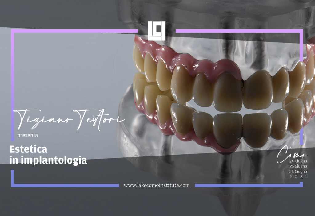 Corso di estetica in implantologia a livello dei settori frontali