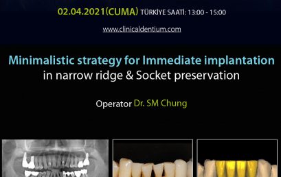 02.04.2021 Dentium Live Surgery – Minimalistic strategy for Immediate implantation in narrow ridge & Socket preservation