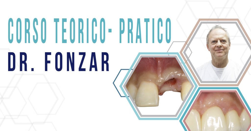 GESTIONE DEI TESSUTI MOLLI PARODONTALI E IMPLANTARI