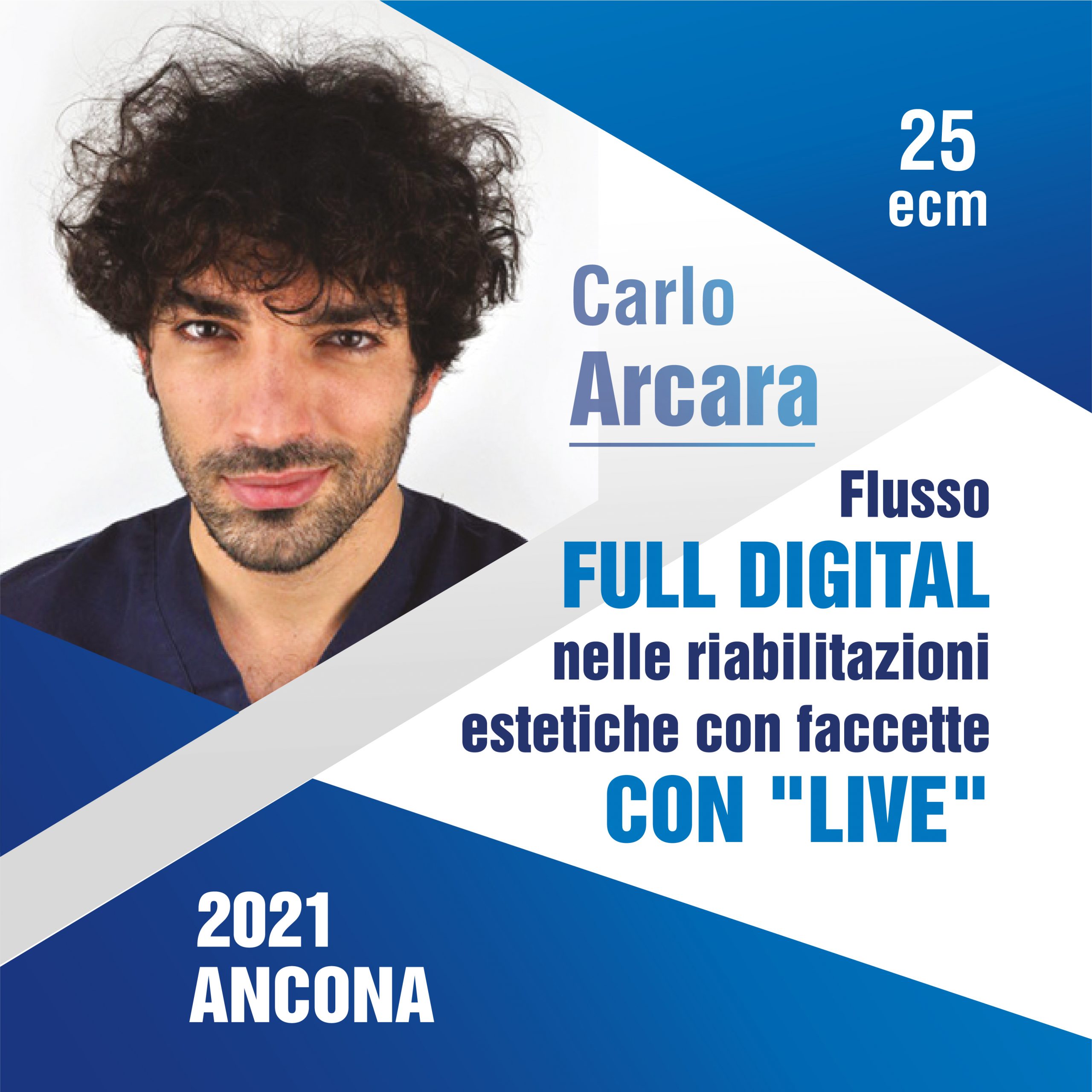 FLUSSO FULL DIGITAL NELLE RIABILITAZIONI ESTETICHE CON FACCETTE