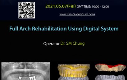 07.05.2021 Dentium Live Surgery – Full Arch Rehabilitation Using Digital System