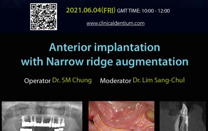 04.06.2021 Dentium Live Surgery