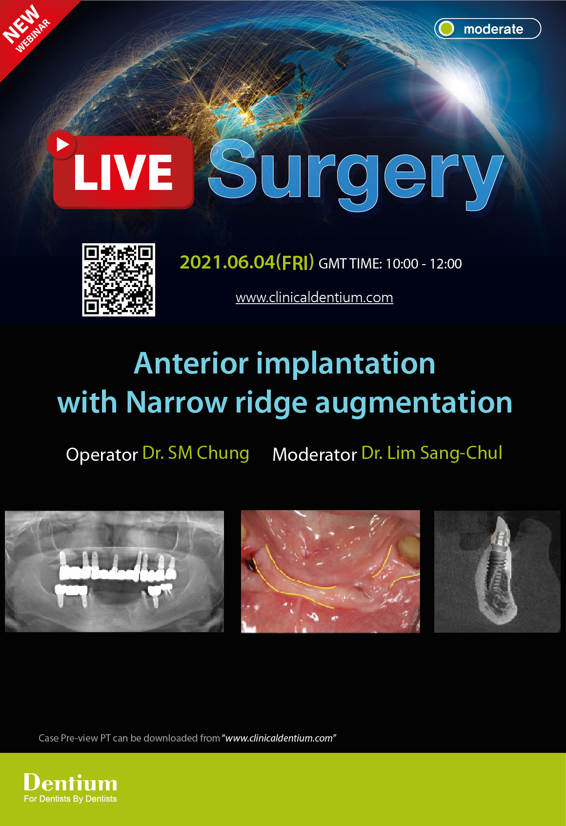 04.06.2021 Dentium Live Surgery
