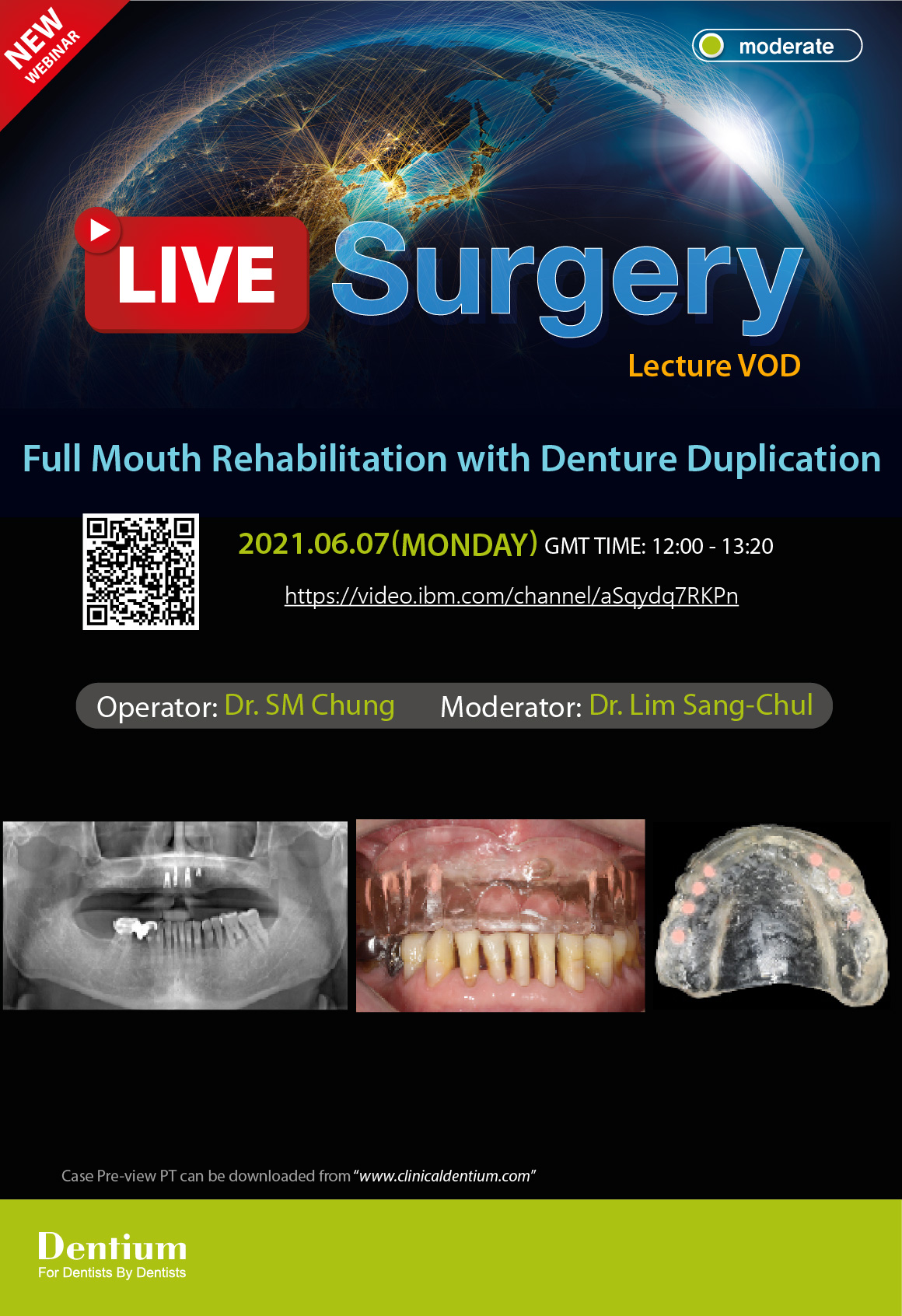 07.06.2021 Dentium Live Surgery