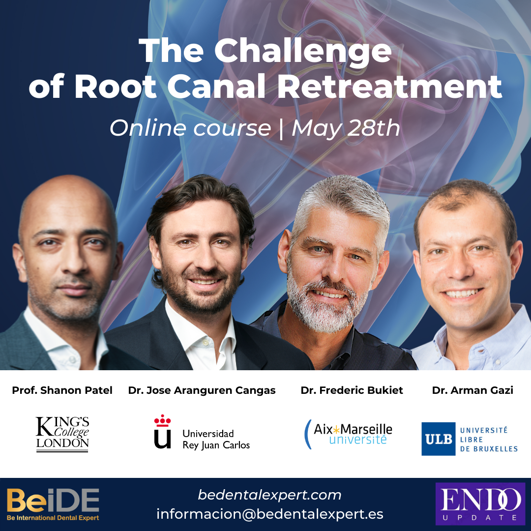 The Challenge of Root Canal Retreatment