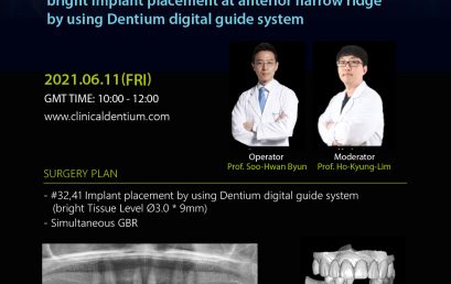 11.06.2021 Dentium Live Surgery