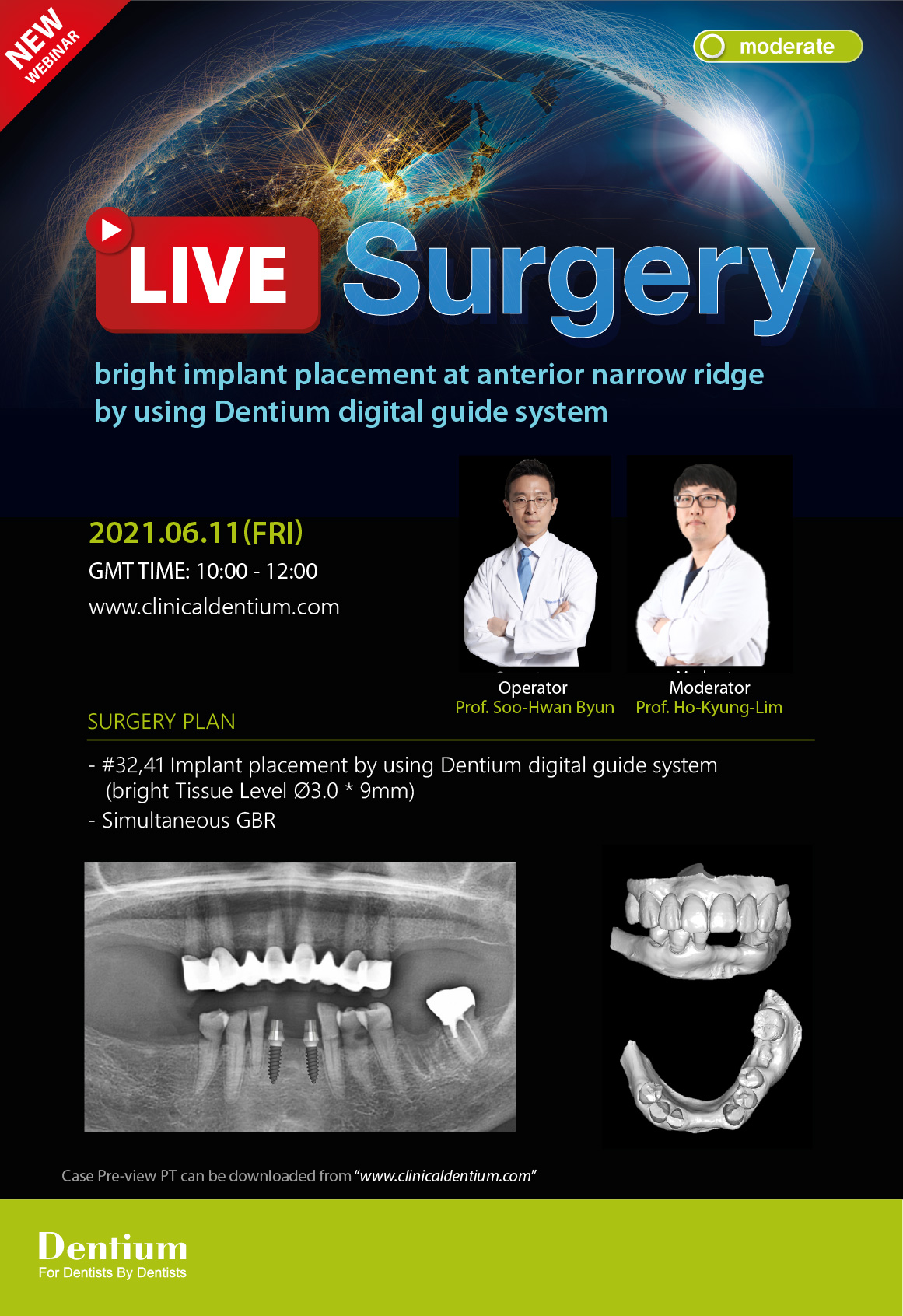 11.06.2021 Dentium Live Surgery