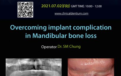 02.07.2021 Dentium Live Surgery