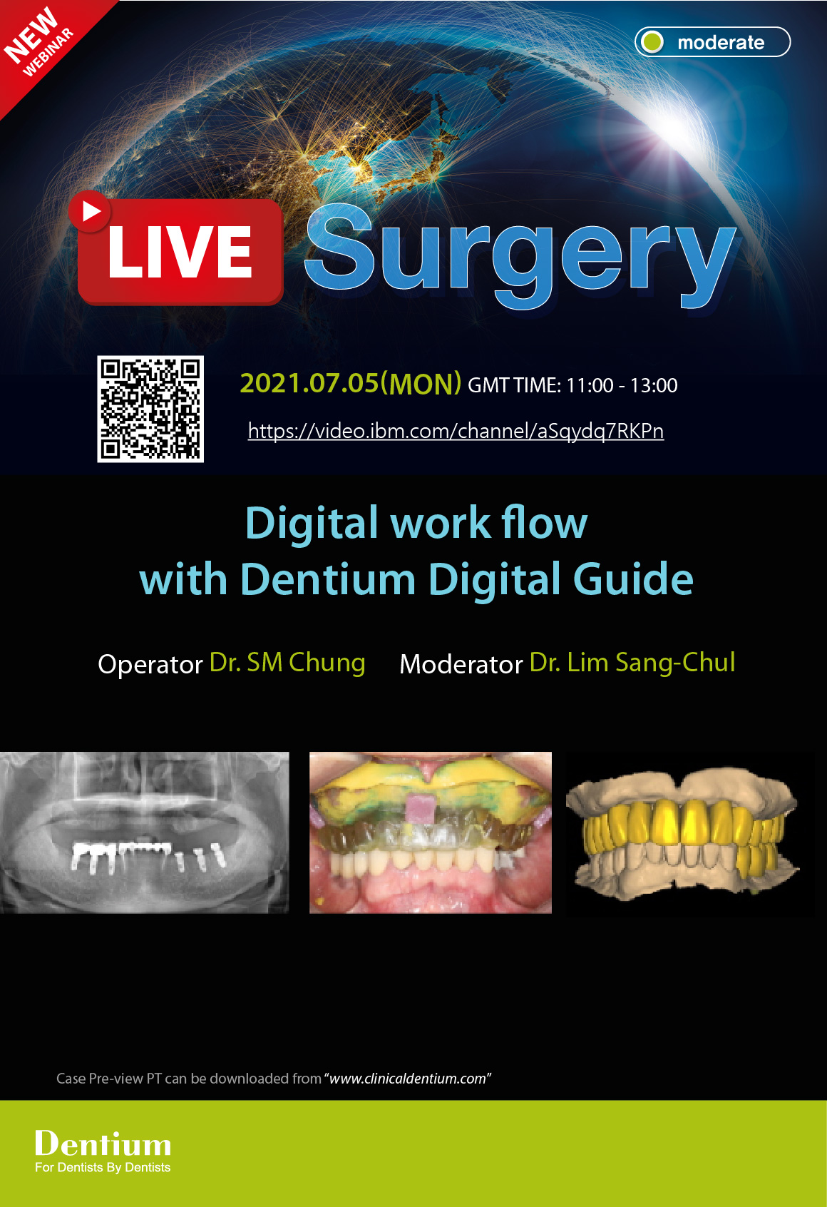 05.07.2021 Dentium Live Surgery