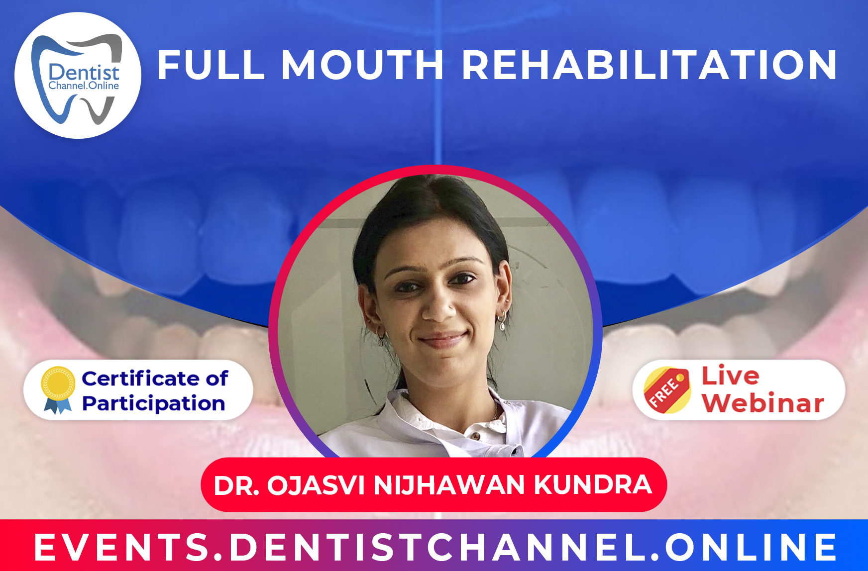 FULL MOUTH REHABILITATION