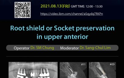 13.08.2021 Dentium Live Surgery