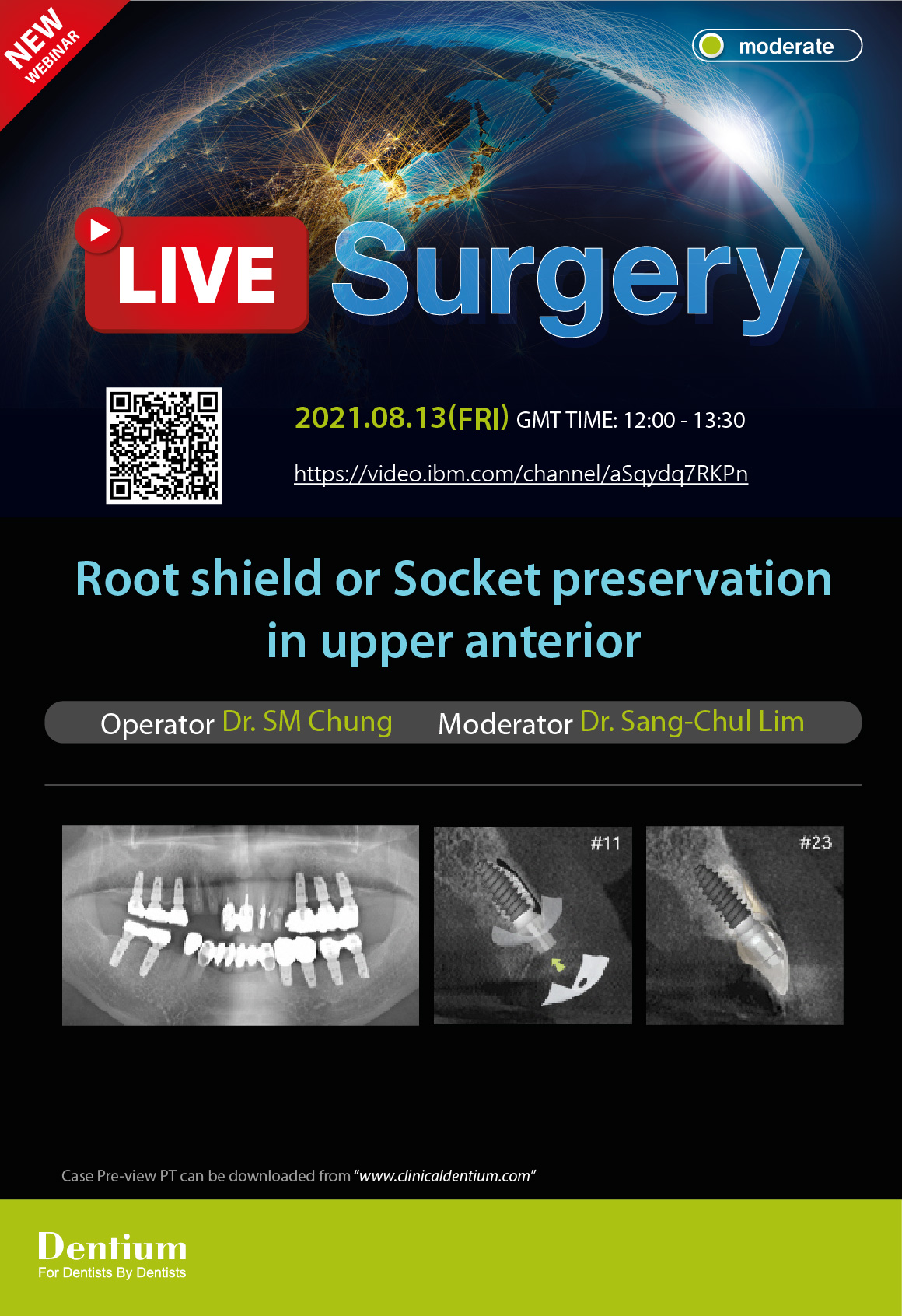13.08.2021 Dentium Live Surgery
