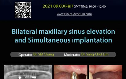 03.09.2021 – Dentium Webinar