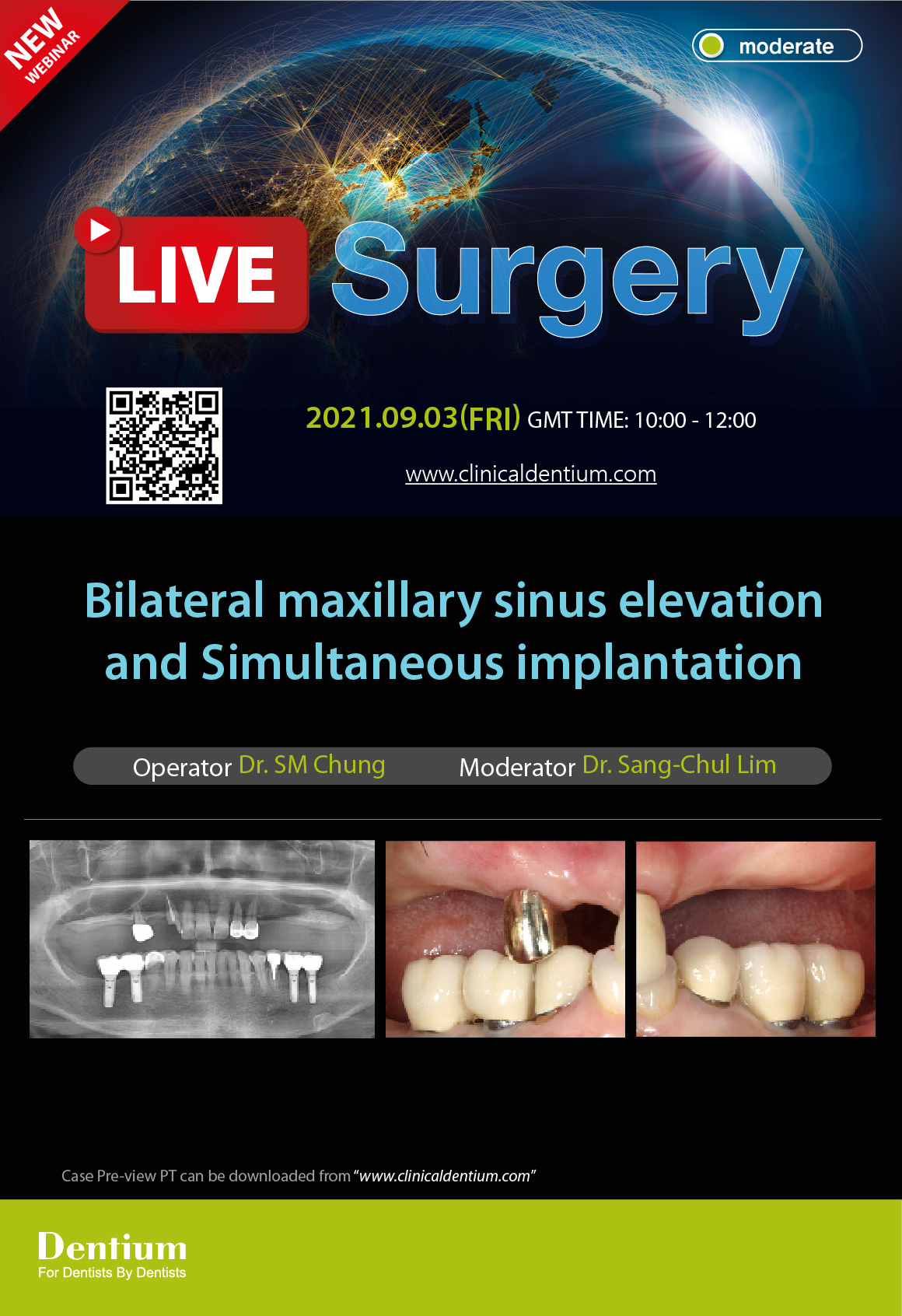 03.09.2021 – Dentium Webinar