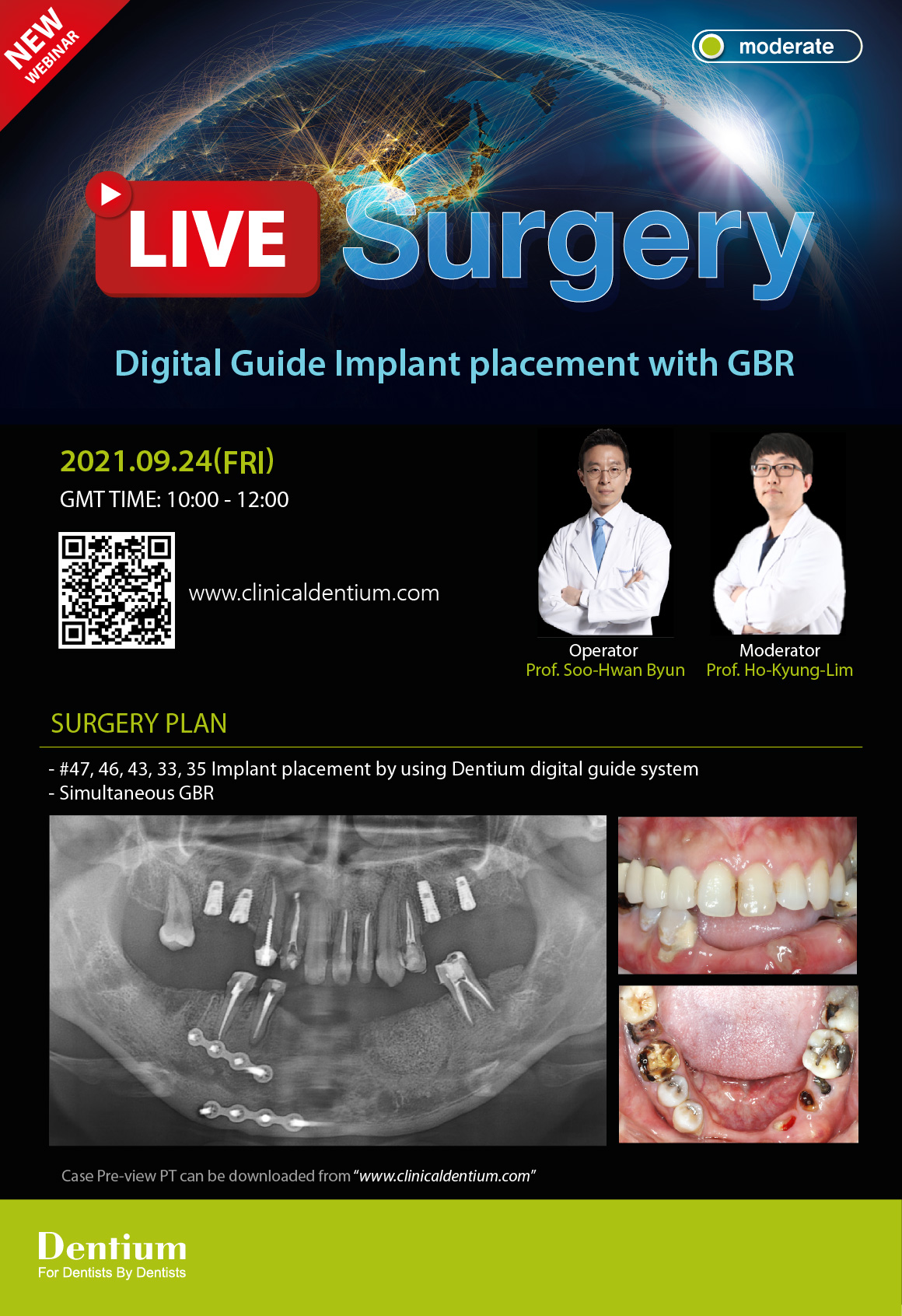 24.09.2021 Dentium Live Surgery