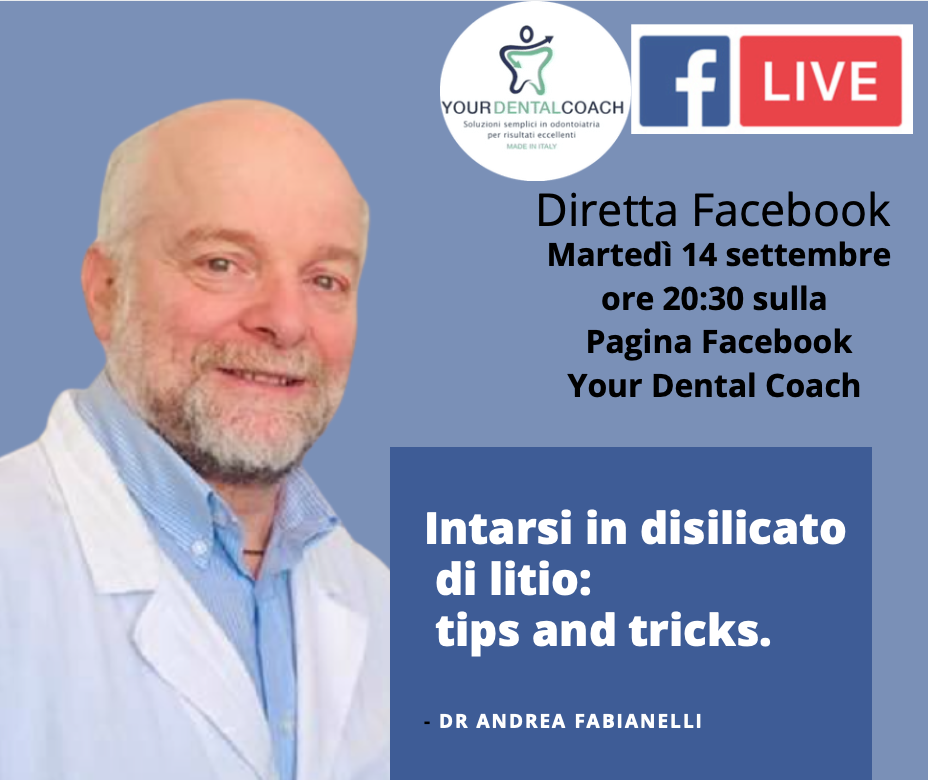 Intarsi in disilicato di litio