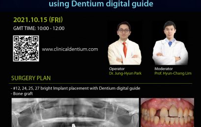 15.10.2021 – Dentium Webinar
