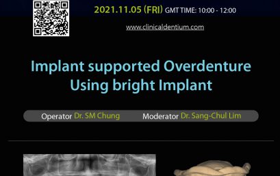 05.11.2021 – Dentium Live Surgery