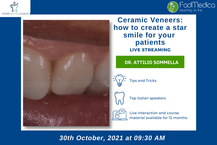 Ceramic Veneers: how to create a star smile for your patients