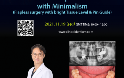 19.11.2021 – Dentium Live Surgery