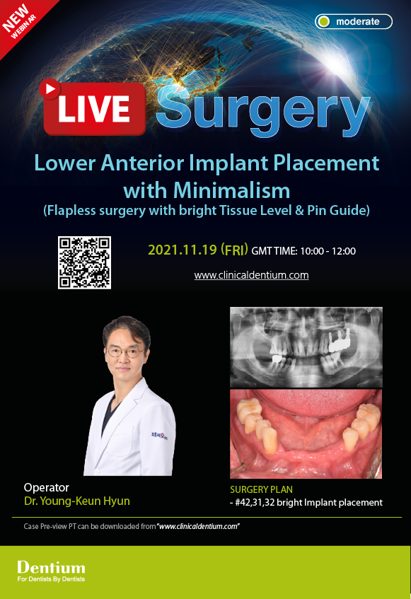 19.11.2021 – Dentium Live Surgery