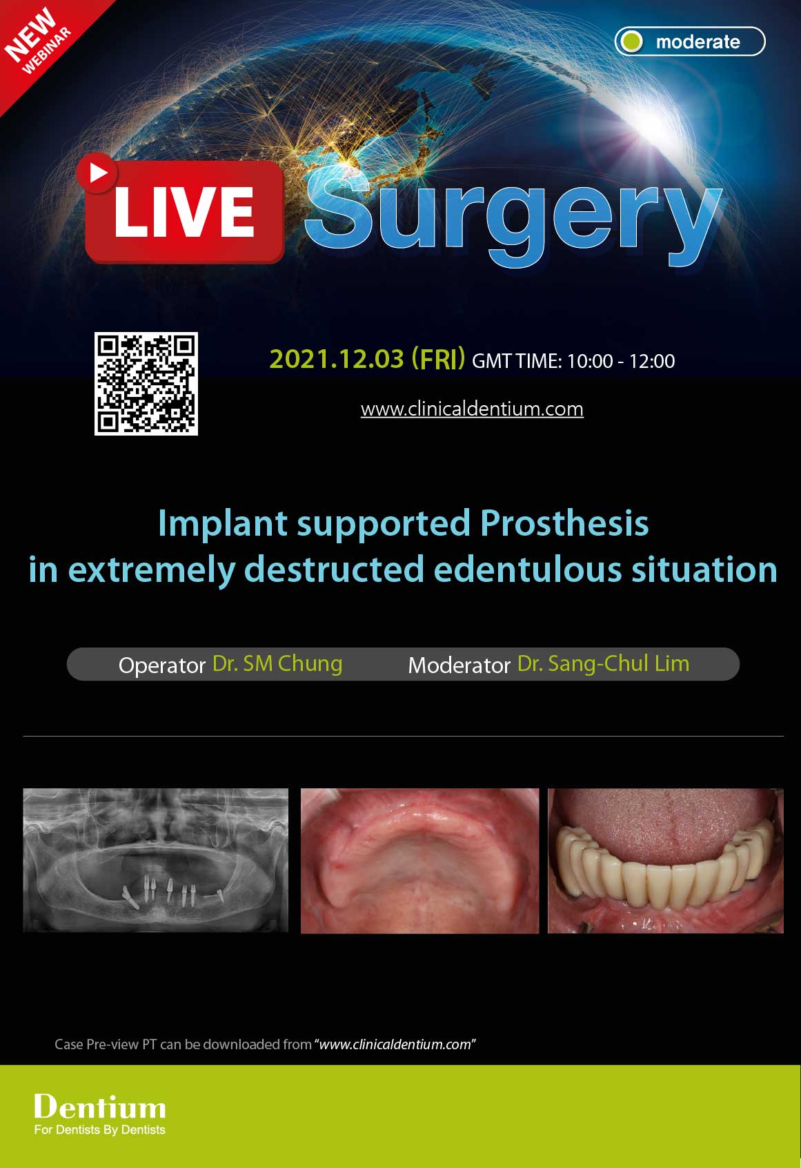 03.12.2021 – Dentium Live Surgery