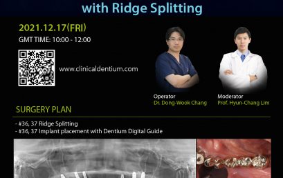 17.12.2021 Dentium Live Surgery