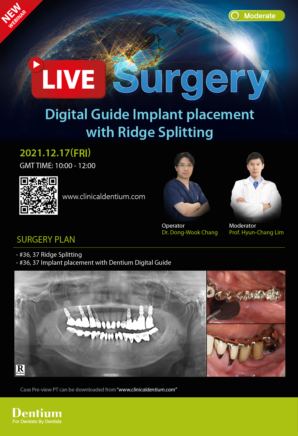 17.12.2021 Dentium Live Surgery