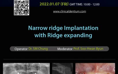 07.01.2022 Dentium Live Surgery