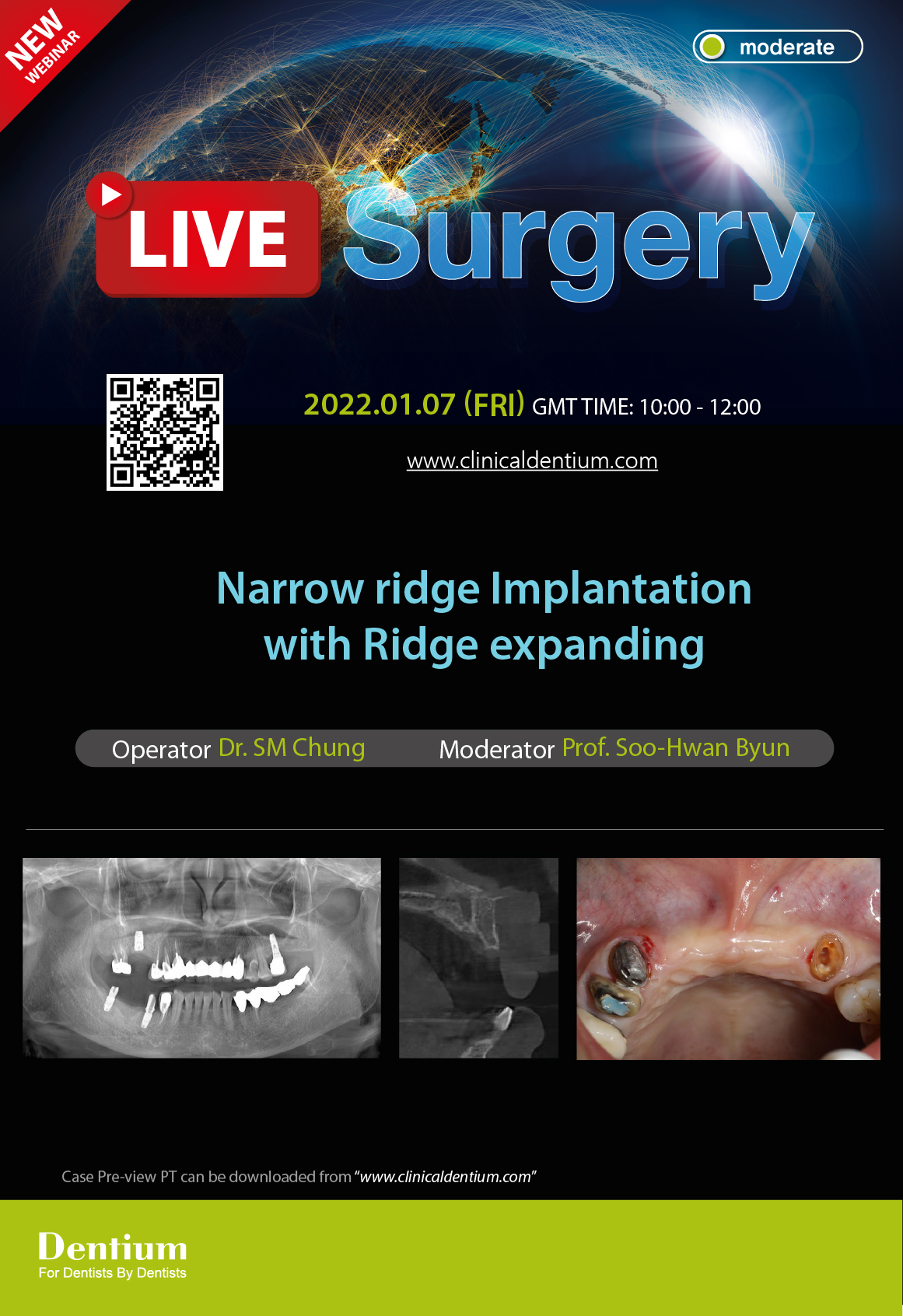 07.01.2022 Dentium Live Surgery