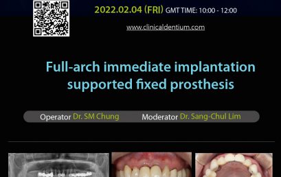 04.02.2022 Dentium Live Surgery
